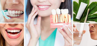 Cómo Conseguir Implantes Dentales en España: Guía Completa para Mujeres Mayores